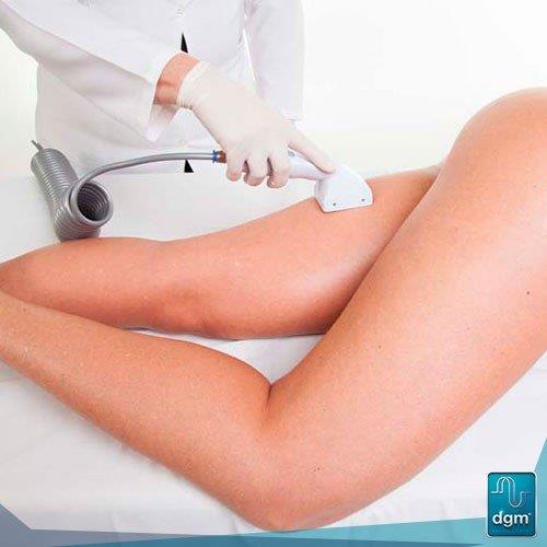 Aparelho de endermologia