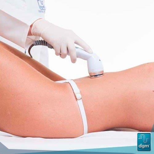 Aparelho de lipocavitação