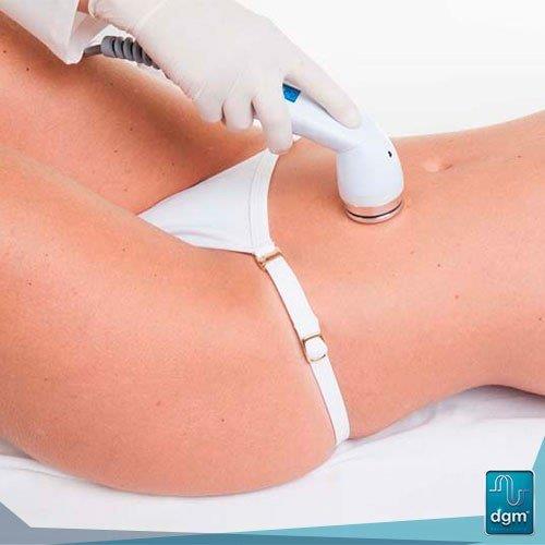 Aparelho de lipocavitação