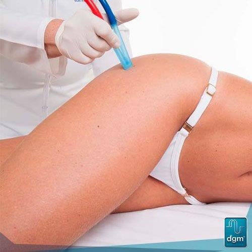 Aparelho peeling de cristal