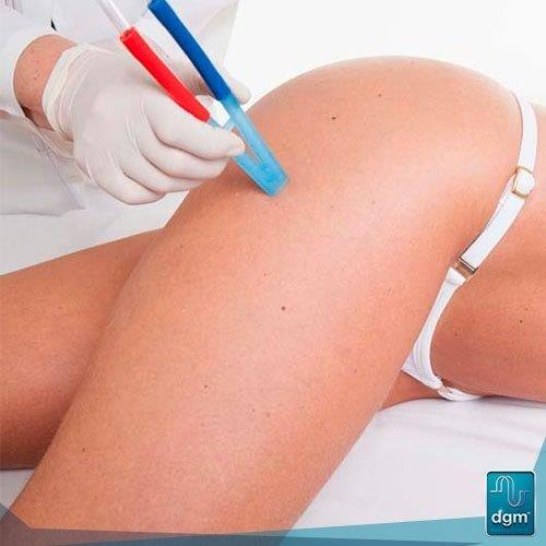 Aparelho peeling de cristal